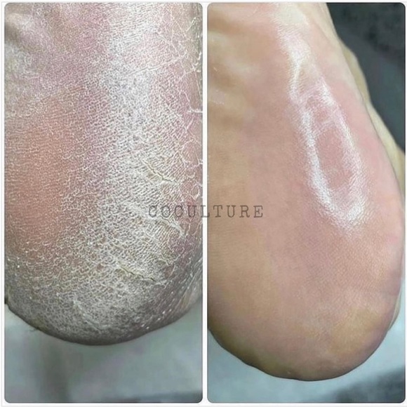 Callus Remover Pedicure Dead skin heels toe - Picture 4 of 4